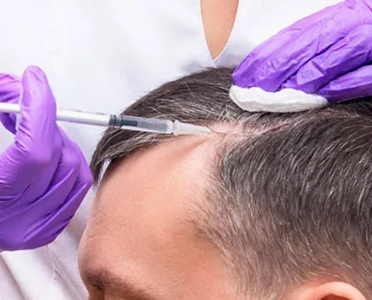 injection-treatment-hair-loss